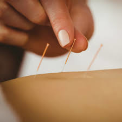 Helpt acupunctuur bij oorsuizen?